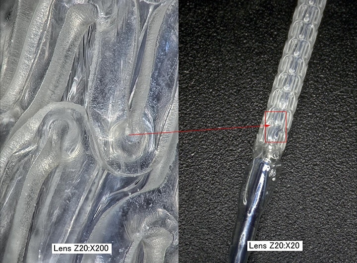 생체 흡수성 스텐트의 확대 화상(왼쪽: 200× / 오른쪽: 20×)